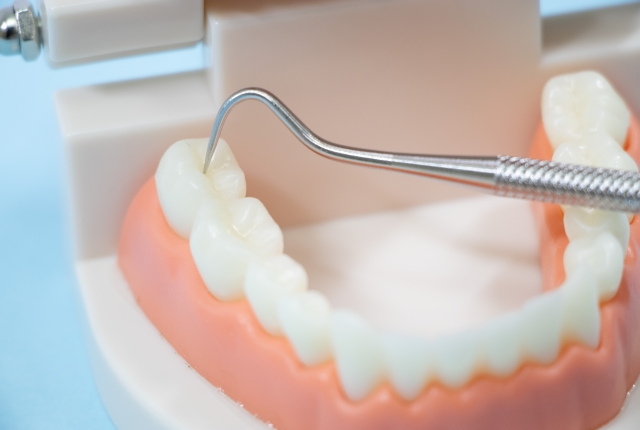 詰め物・かぶせ物が取れてしまったときの対処法